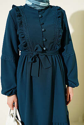 Brit Düğmeli Güpür Detaylı Elbise Petrol Yeşili - Elbise